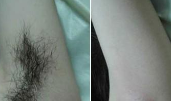 广州肤康皮肤病医院