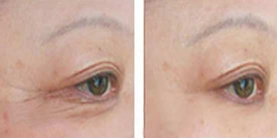 广州肤康皮肤病医院